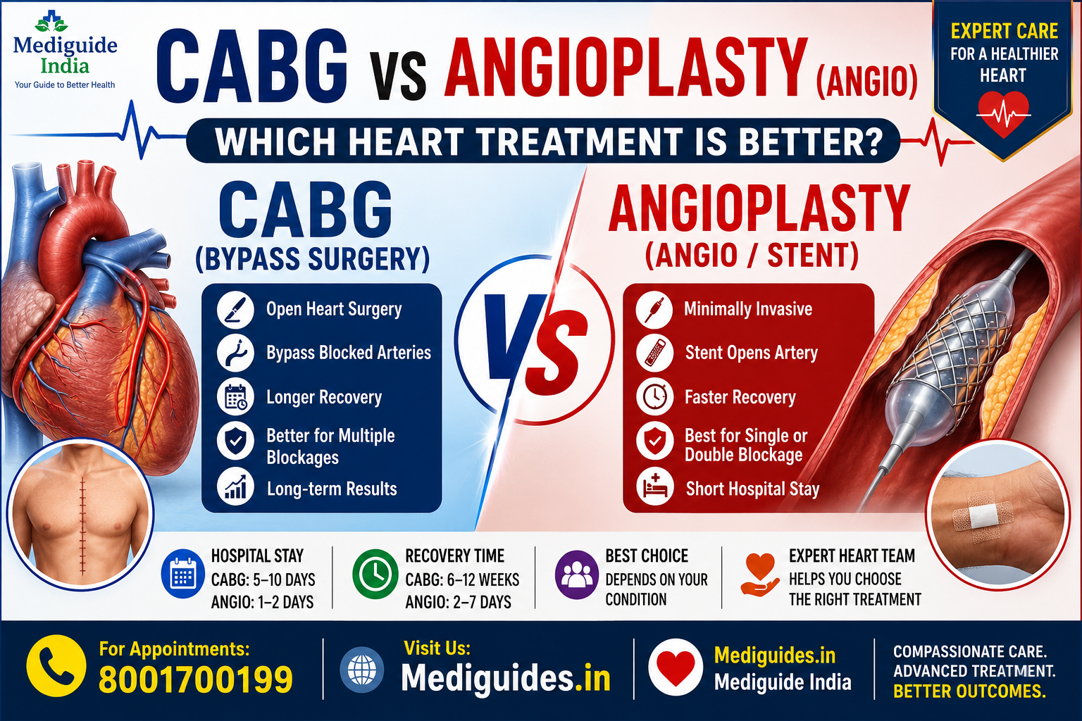 ABG vs Angioplasty